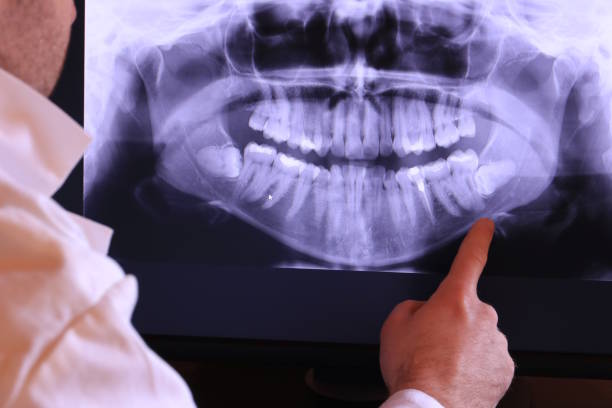 Best Weekend Emergency Dentist in Nicholasville, KY