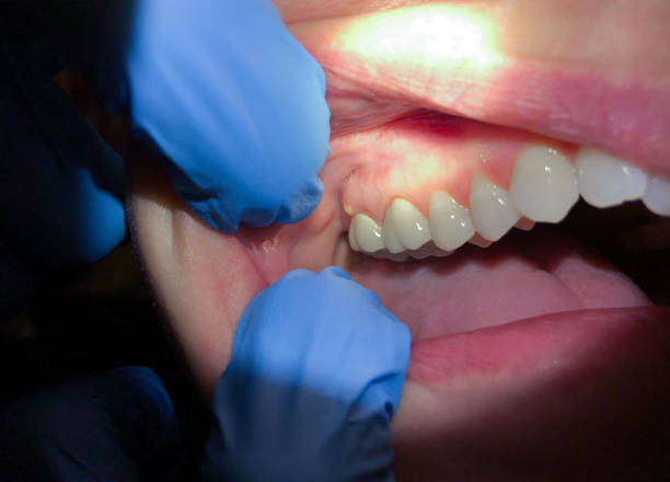 Best Orthodontic Emergency Dentist in Nicholasville, KY